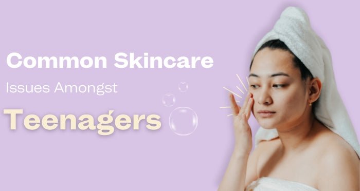 Common Skincare Issues Amongst Teenagers