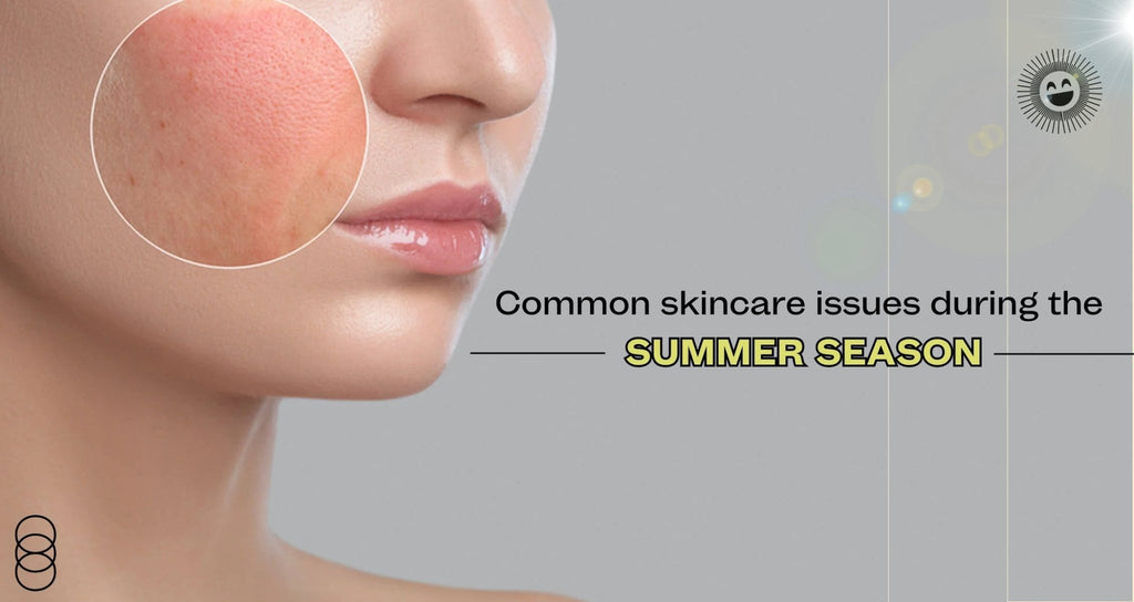 Common skincare issues during the summer season