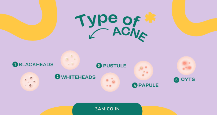 How can I treat different types of acne, blemishes and scars?